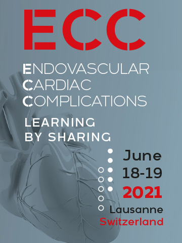 ECC